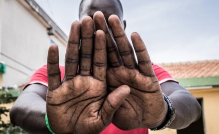 A young man from Gambia holds his hands in front of the camera, covering his face