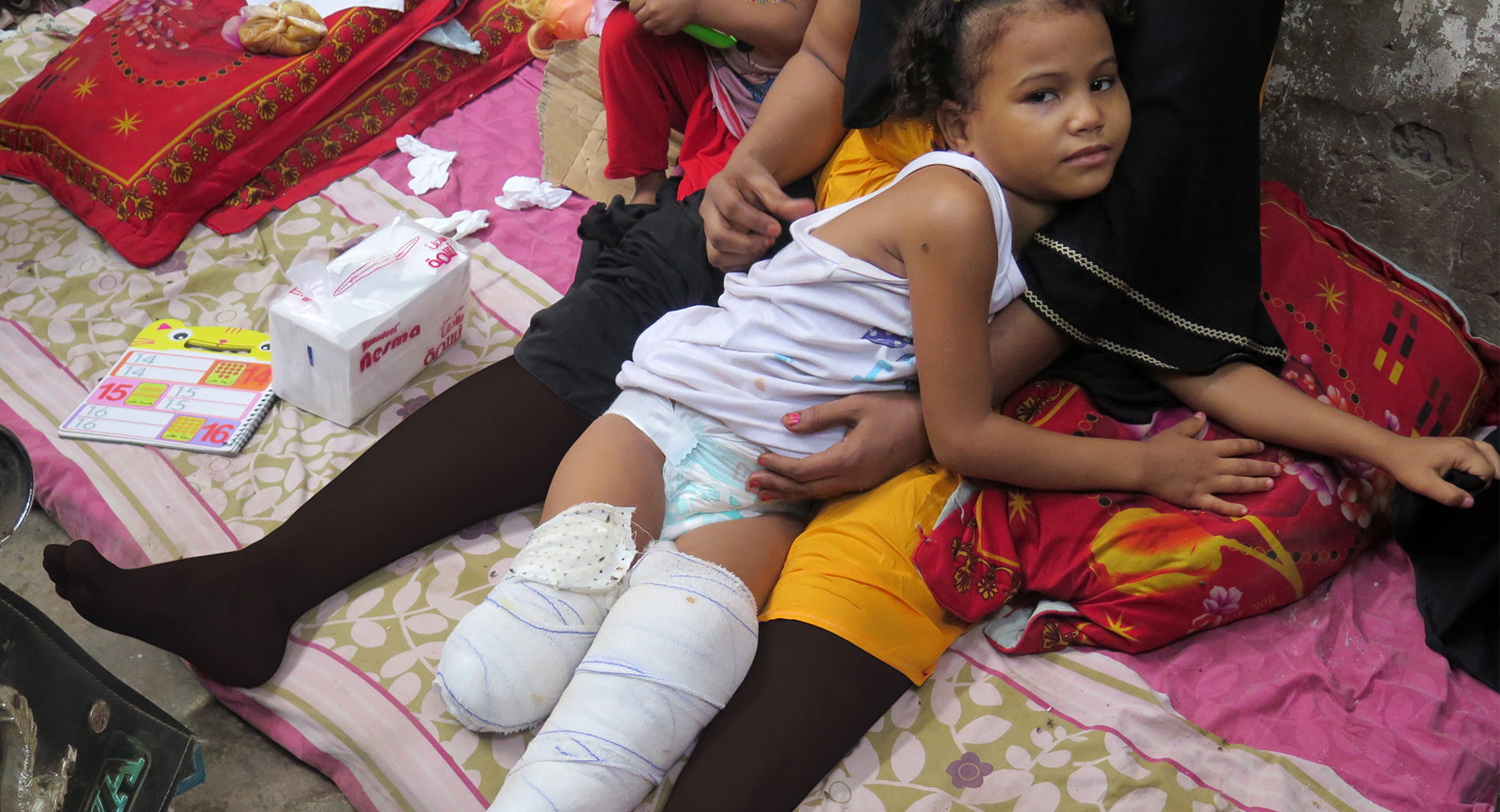 7-year-old Samia, who was injured in a bomb attack in Yemen.