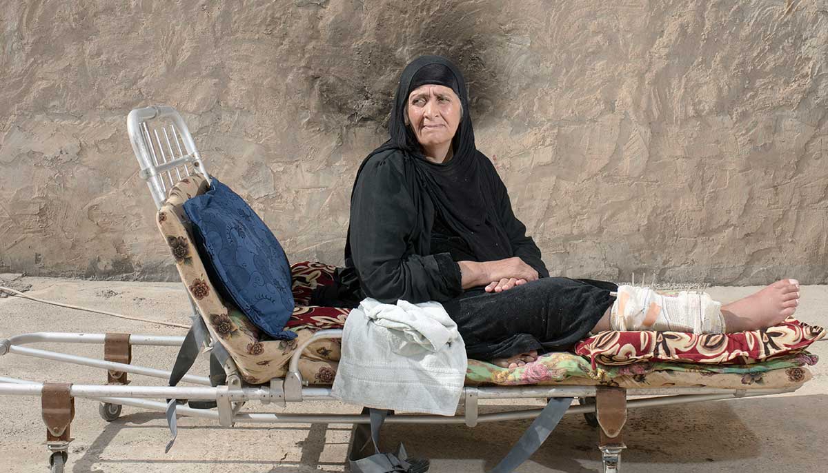 West Mosul image of a woman with a bandage on her leg